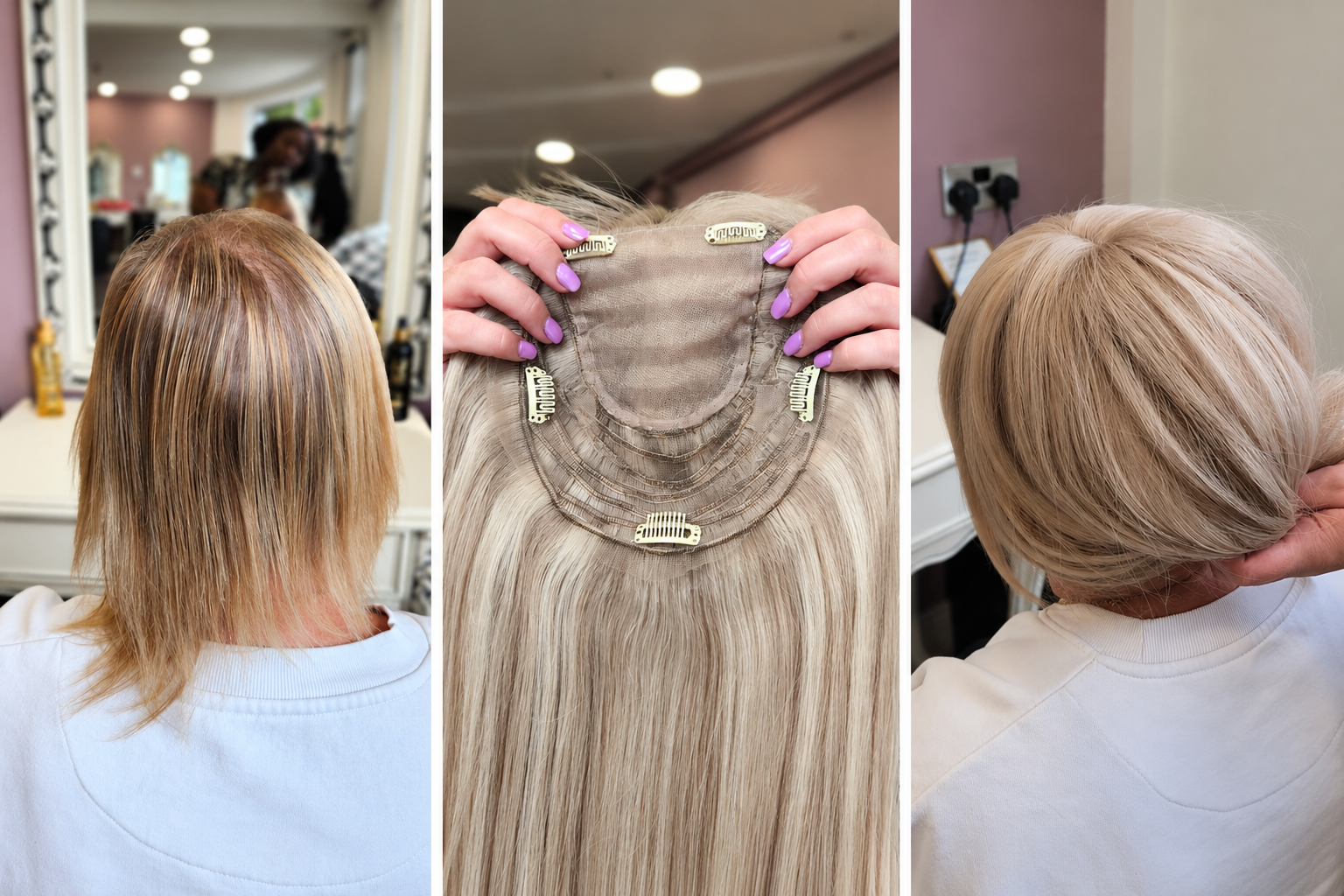 Genuine iHobbs Crown Enhancer client journey showing the starting point, Crown Enhancer and finished result