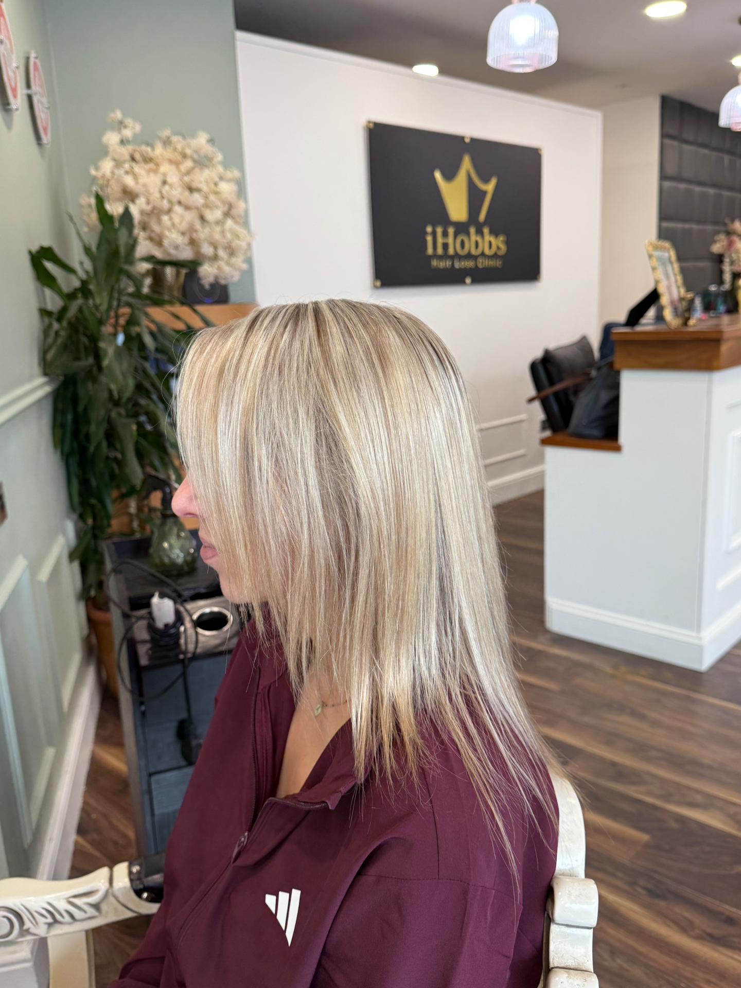 Before — hair extensions client at iHobbs Hair Loss Clinic